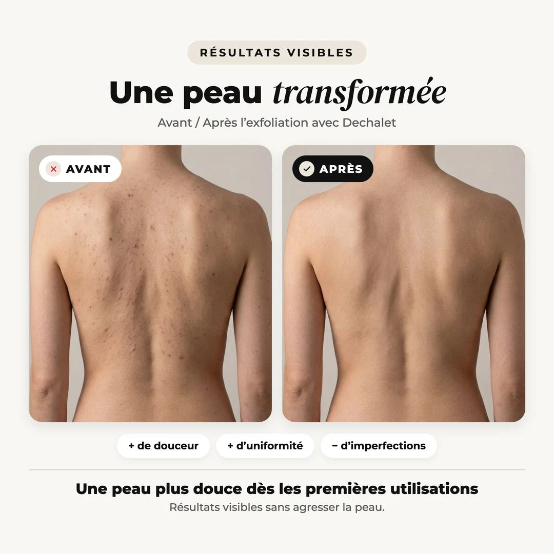 Velura™ - Serviette de douche exfoliante